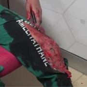 Gümüşhane Devlet Hastanesi’nde Gerçekçi Tatbikat