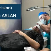 The Search for the Best Hair Transplant Technique 2026